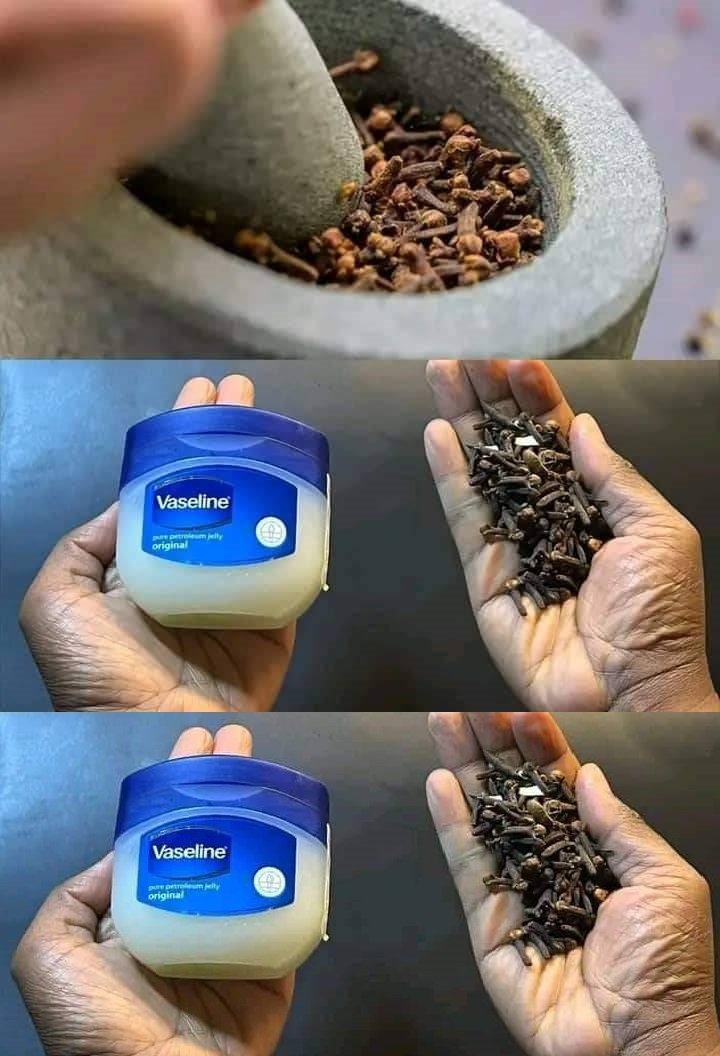 Mix Cloves with Vaseline: A Secret No One Will Ever Tell You. Thank Me Later